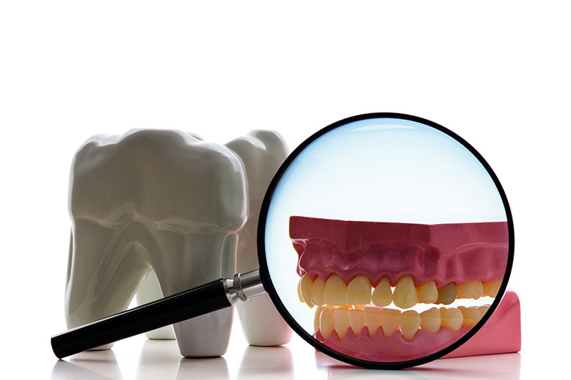 Root Canal in Wilmington