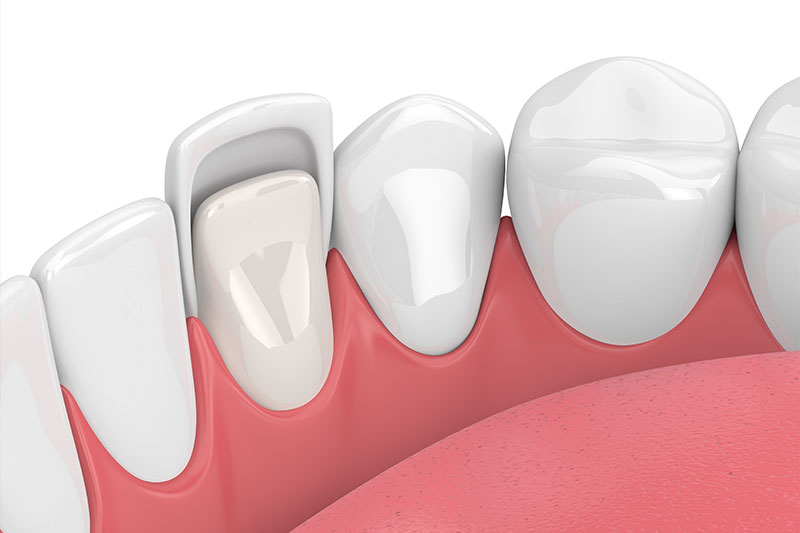 Cosmetic Dentistry in Wilmington